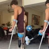 Σταύρος Φλώρος: Τα πρώτα βήματα με το προσθετικό πόδι και το συγκινητικό μήνυμα για την υγεία